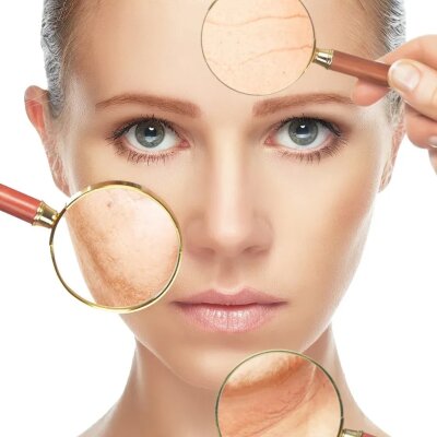 Tratament Sensitive PEEL