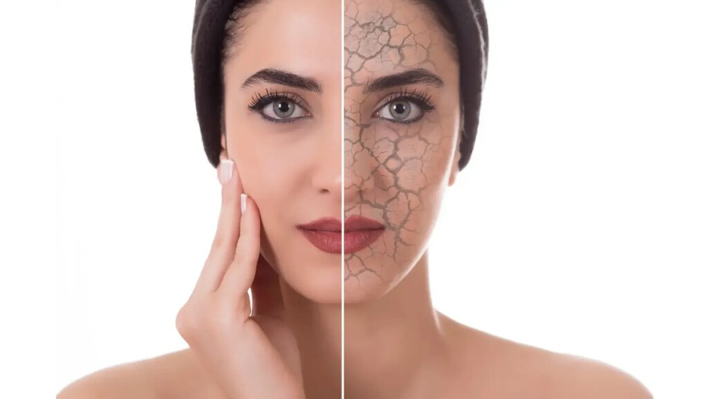 Tratament Xeroskin PEEL