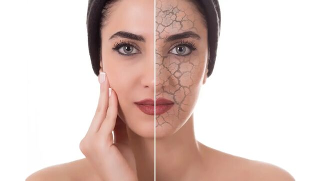 Tratament Xeroskin PEEL