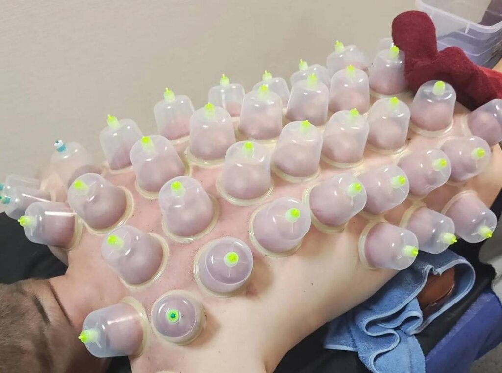 Ventuză Terapeutică Nr.7 din Plastic și Cauciuc - imaginea 2