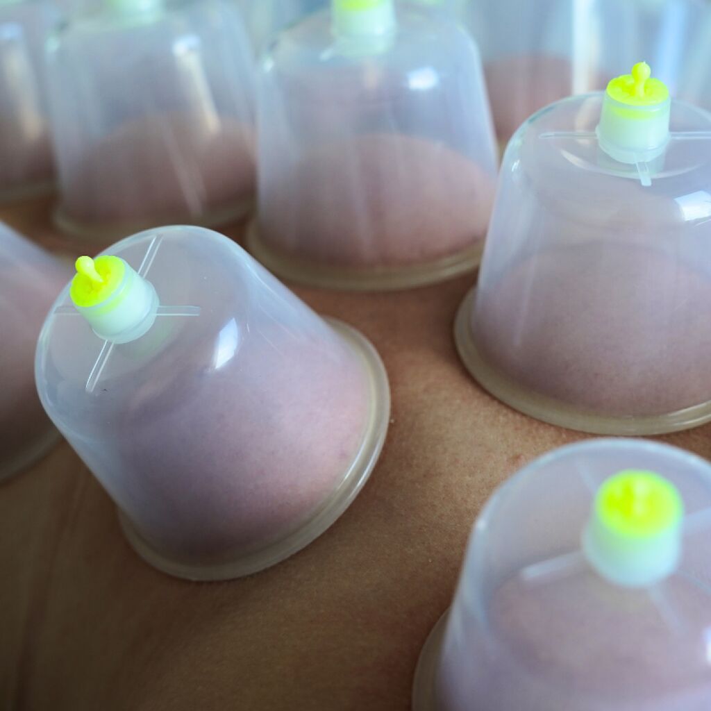 30 buc. Ventuze Terapeutice Nr.8 din Plastic si Cauciuc - imaginea 4