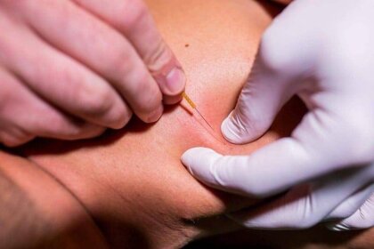 Ce pierzi dacă nu participi?